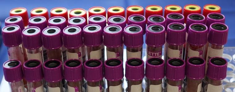 8 новоустановени случаи на коронавирус в област Добрич 