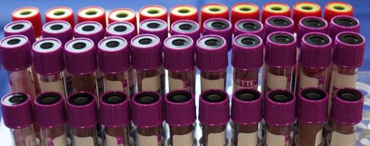 В 8 области почти 100% е разпространението на британския щам  