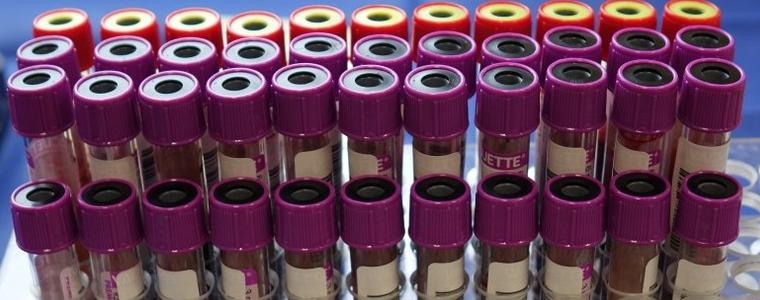 47 са новите случаи на COVID-19  в област Добрич
