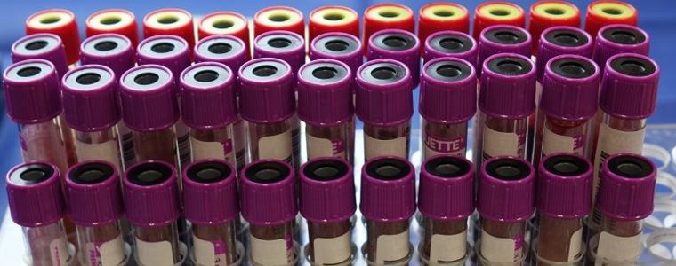 56 новоустановени случаи на коронавирус в област Добрич