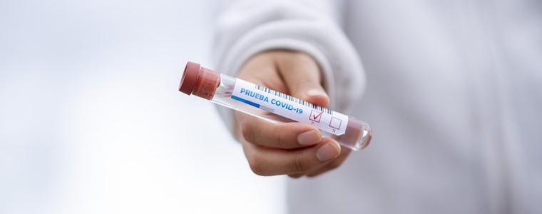 74 новорегистрирани с COVID-19 в област Добрич 