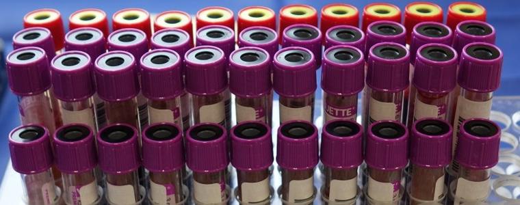 Поредно денонощие с над 100 нови случаи на COVID-19  в област Добрич