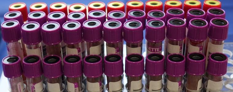 22 са новорегистрираните случаи на COVID-19 в област Добрич 