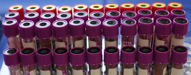 Няма регистрирани случаи на COVID-19 в област Добрич през изминалото денонощие