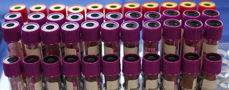3 са новоустановените случаи на коронавирус в област Добрич