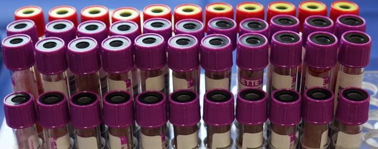 3 са новоустановените случаи на коронавирус в област Добрич