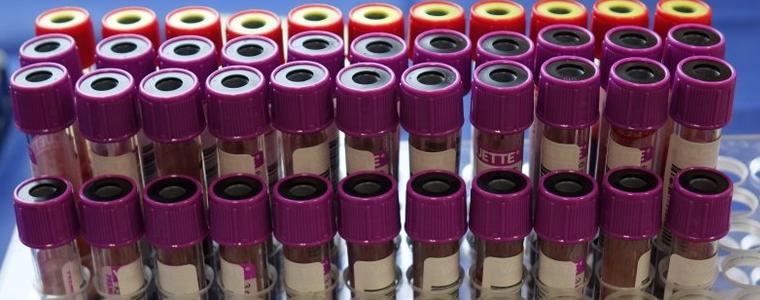 Няма регистрирани случаи на COVID-19 в област Добрич, 28 са в страната