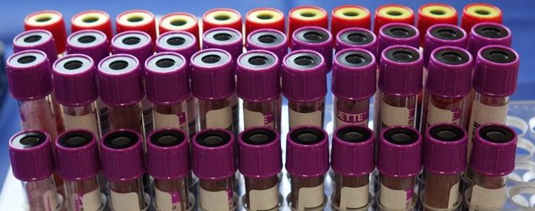 Няма регистрирани случаи на COVID-19 в област Добрич вчера, 27 са в страната
