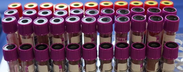 Няма регистрирани случаи на COVID-19 в област Добрич през изминалото денонощие