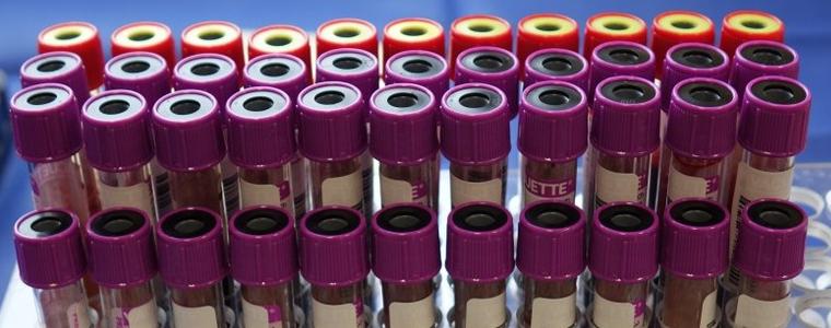 32 са новорегистрираните случаи на коронавирус в област Добрич 