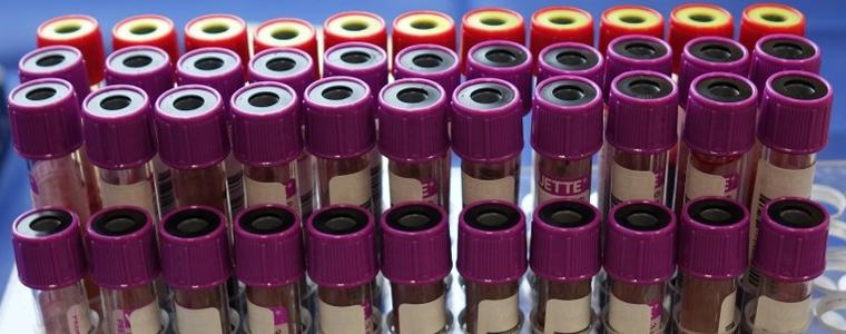 32 са новоустановените случаи на коронавирус в област Добрич