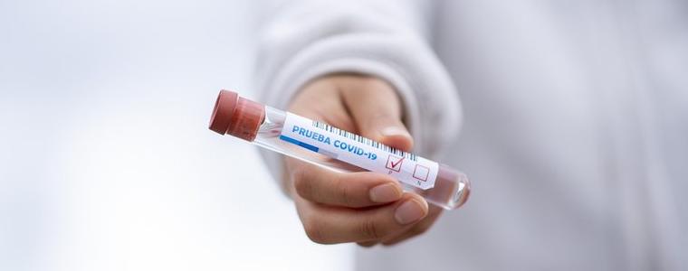 10 са новорегистрираните случаи на коронавирус в област Добрич 