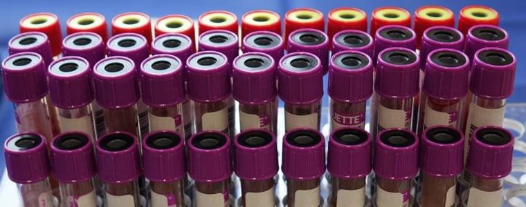 77 са новите регистрирани случаи на коронавирус в област Добрич 