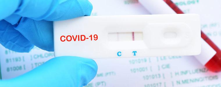 Туристическият сектор настоява да им дадат безплатни COVID тестове