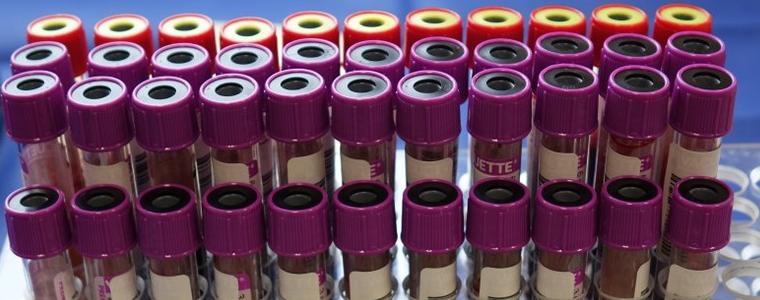 70 са новите регистрирани случаи на коронавирус в област Добрич 