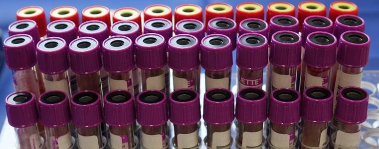 11 са новорегистрираните случаи на коронавирус в област Добрич