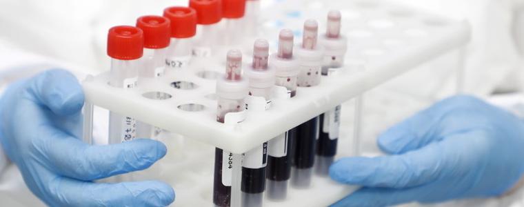 Трима новозаразени в област Добрич, 16% са положитените проби в страната