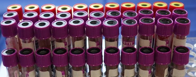 29 са новите регистрирани случаи на коронавирус в област Добрич