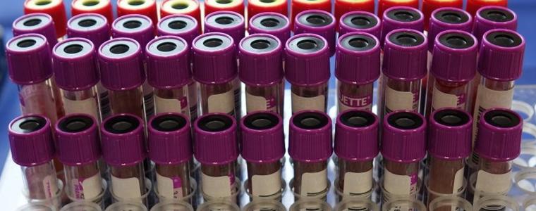 50 са новите регистрирани случи на коронавирус в област Добрич 