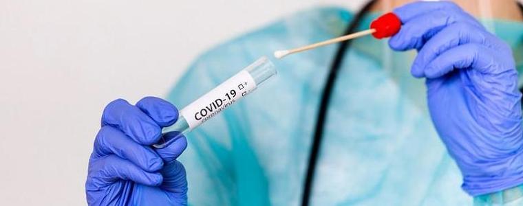 Няма регистрирани случаи на Covid-19 вчера в областта, 321 са в страната