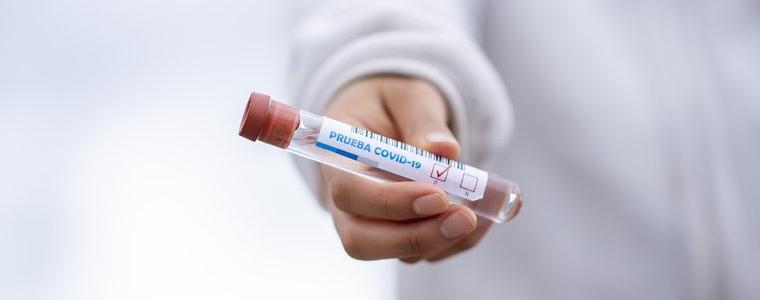 Два нови случая на Covid-19 в област Добрич, 12% положителни проби в страната