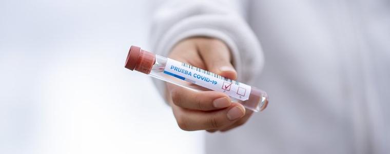 22 са новите регистрирани случаи на коронавирус в област Добрич 