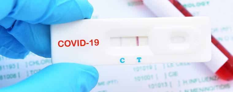 30 са новите регистрирани случаи на коронавирус в област Добрич 