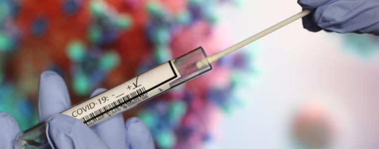 4 са новите случаи на коронавирусна инфекция в областДобрич