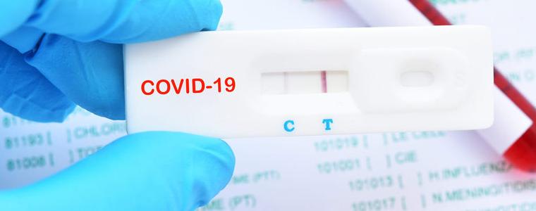 Без потвърдени случаи на коронавирус в област Добрич вчера