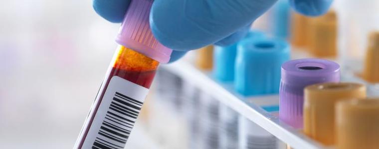 Обсъдиха възможността за разкриване на лаборатория за тестване за наркотици и алкохол в Добрич