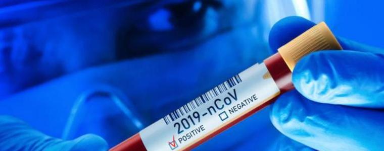 445 нови случая на COVID-19 са потвърдени у нас през последното денонощие, 252 са излекувани