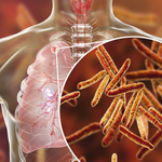 Кампания срещу туберкулозата в Добрич: Шанс за ранна диагностика до 27 март (ЧУЙТЕ)